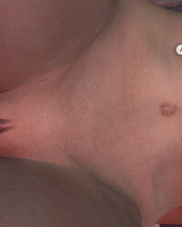 photo-thumb