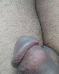 photo-thumb