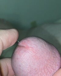 photo-thumb