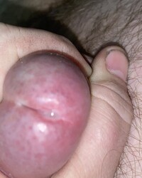 photo-thumb