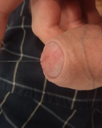 photo-thumb