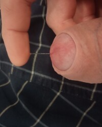 photo-thumb