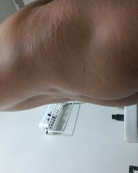 photo-thumb