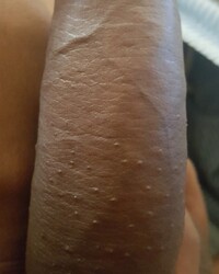 photo-thumb