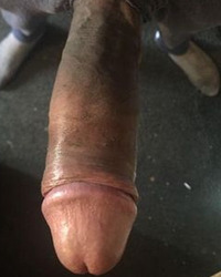 photo-thumb