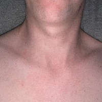 illplaytheromeo的化身