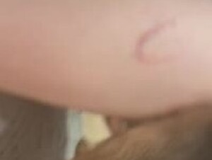 Thumb 7