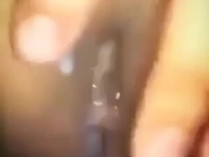 Thumb 9