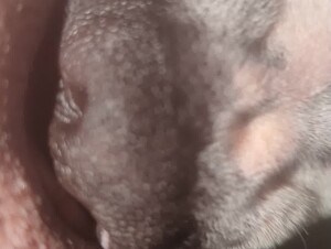 Thumb 9