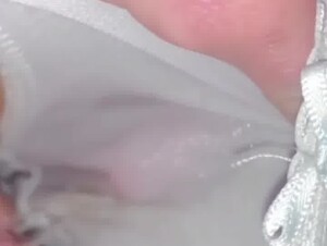Thumb 6