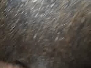 Thumb 9
